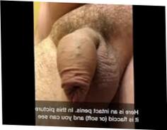 Penis And Foreskin Xphoto Pornography Photo From Samforeskin 640x480